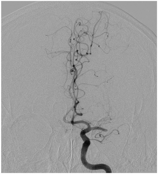 Fig. 4 (A)