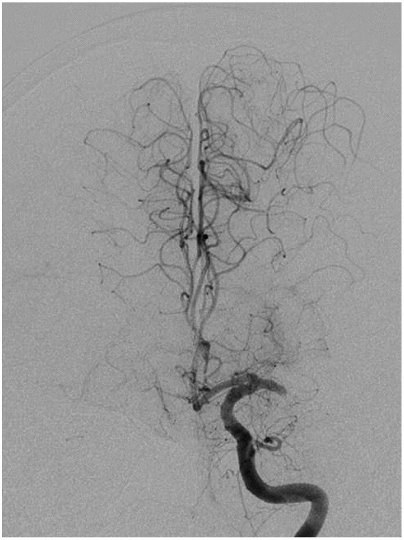 Fig. 5 (A)