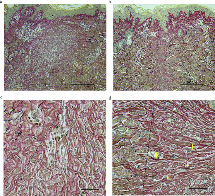 Fig. 10