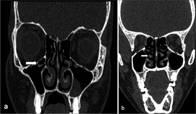 Figure 4: