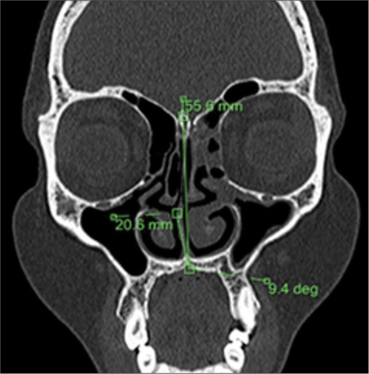 Figure 2: