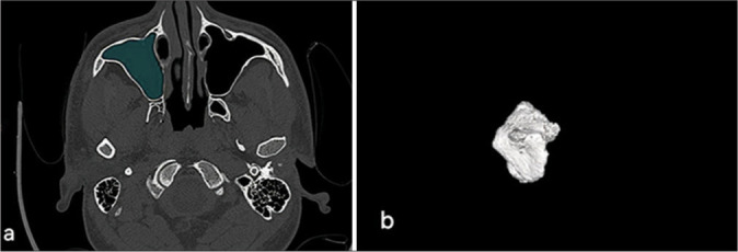 Figure 1: