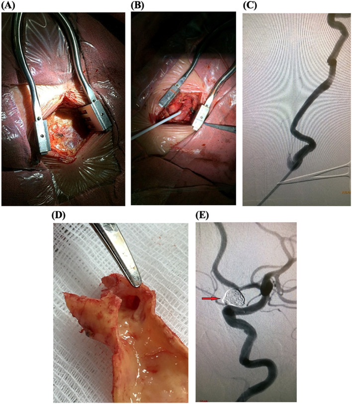 Fig. 2 –