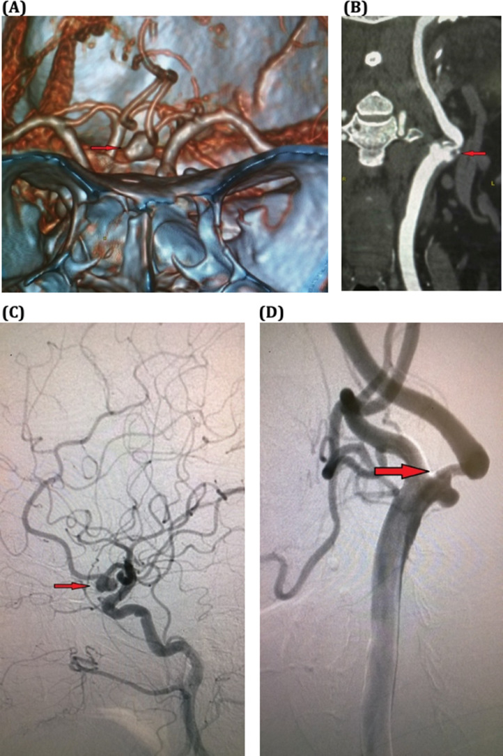 Fig. 1 –