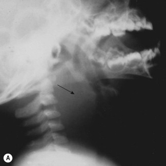 Figure 28-1