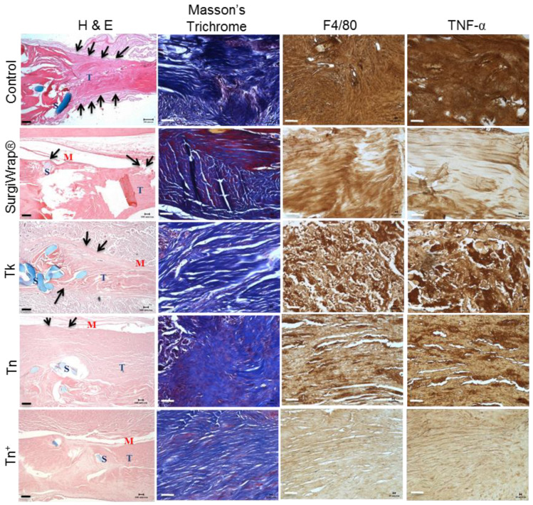 Figure 14