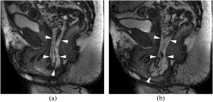 Figure 11.