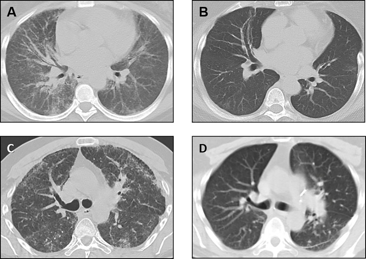 Fig 2