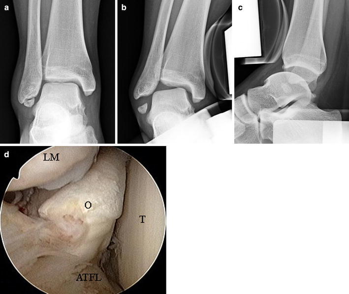 Fig. 3