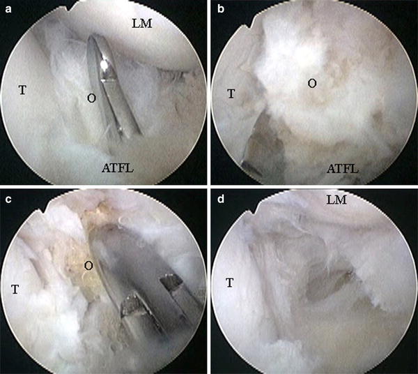 Fig. 2