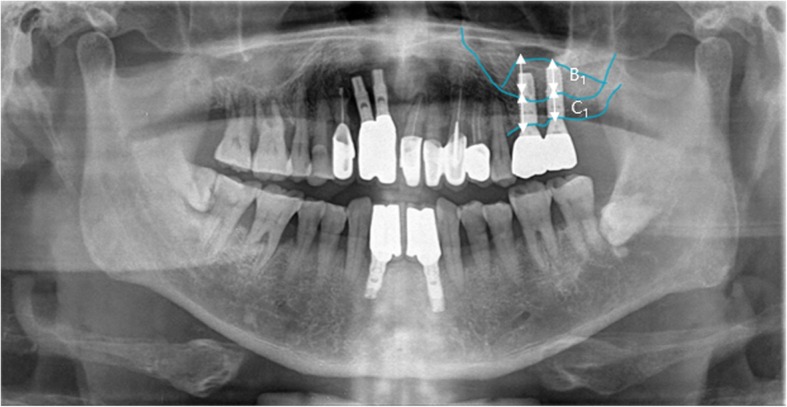 Fig. 4