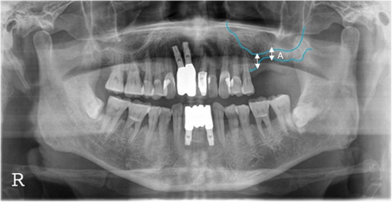 Fig. 2