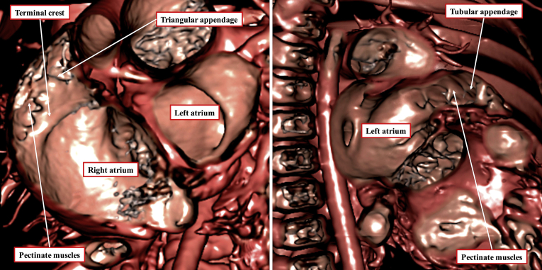 Figure 3