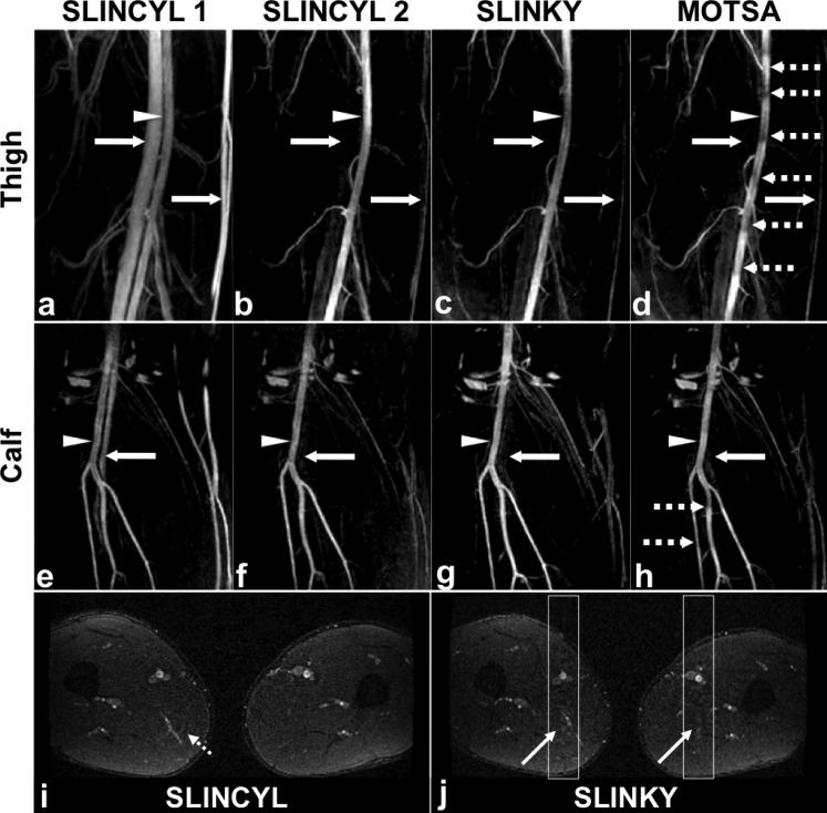 FIG. 4