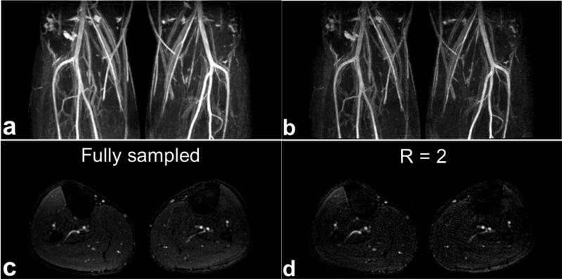 FIG. 6