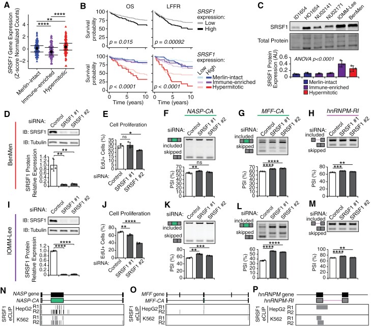 This figure highlights SRSF1 as an RNA splicing factor that is enriched in hypermitotic meningiomas and associated with poor prognosis. Furthermore, this figure demonstrates that SRSF1 knockdown decreases proliferation and alters splicing patterns of hypermitotic meningioma cell lines.