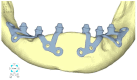 Figure 25