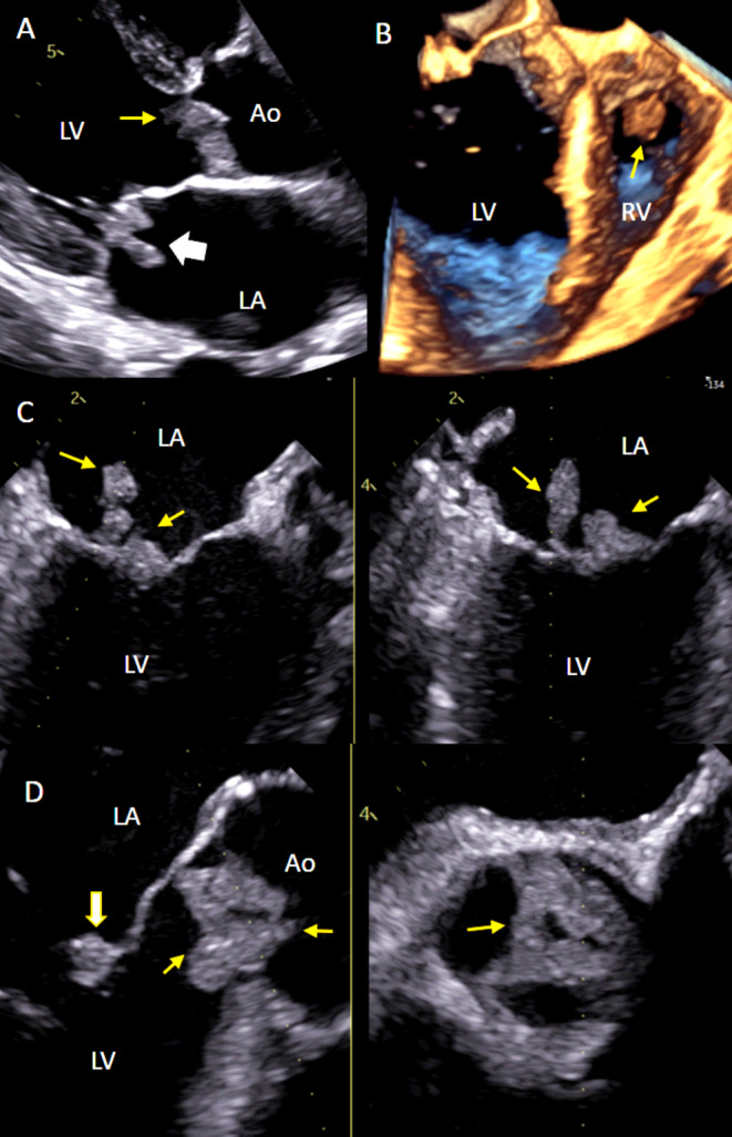 FIGURE 4