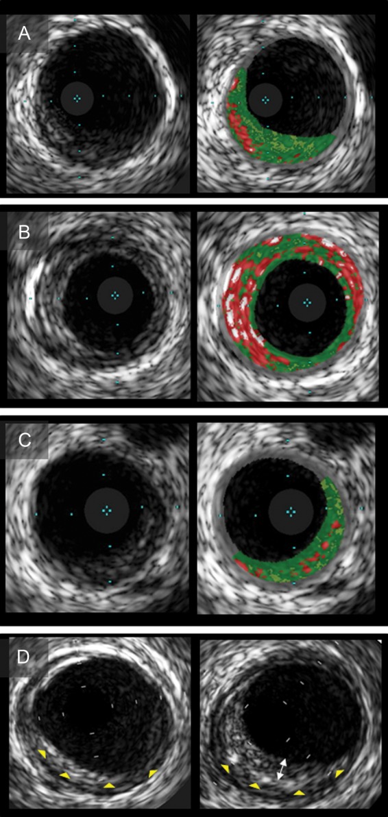 Figure 2