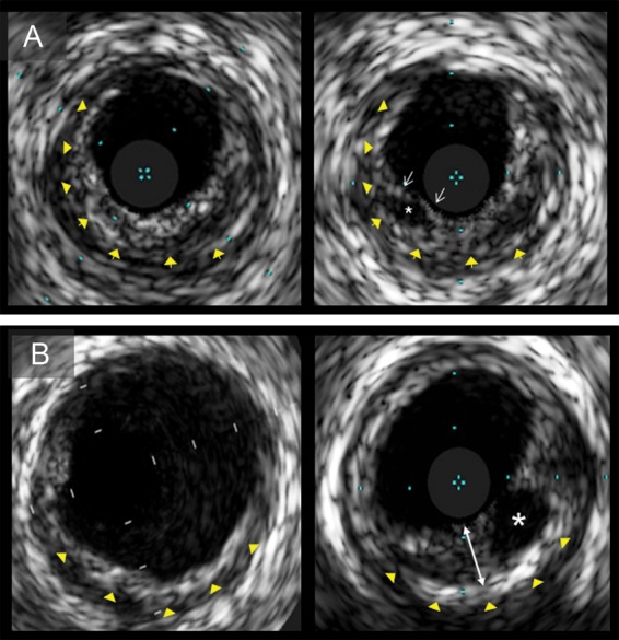 Figure 3