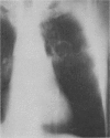 814