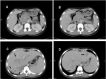 Fig 2: