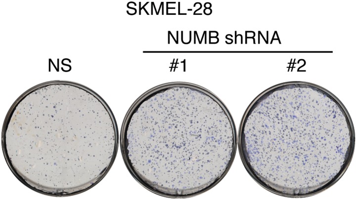 Figure 5—figure supplement 1.