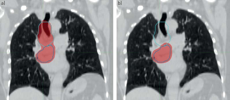 FIGURE 1