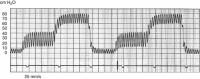 Fig. 10.9