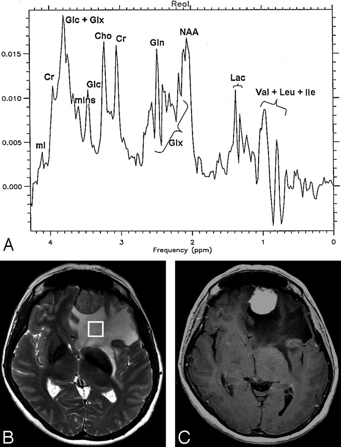 Fig 3.