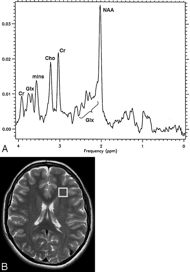 Fig 1.