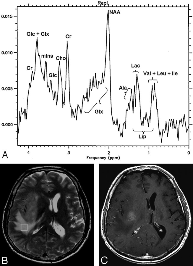 Fig 2.