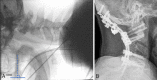 FIG. 4.