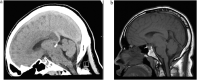 Fig. 1 –