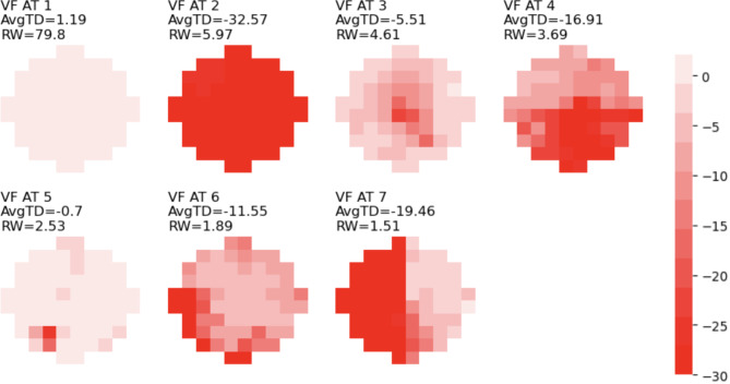 Fig. 4