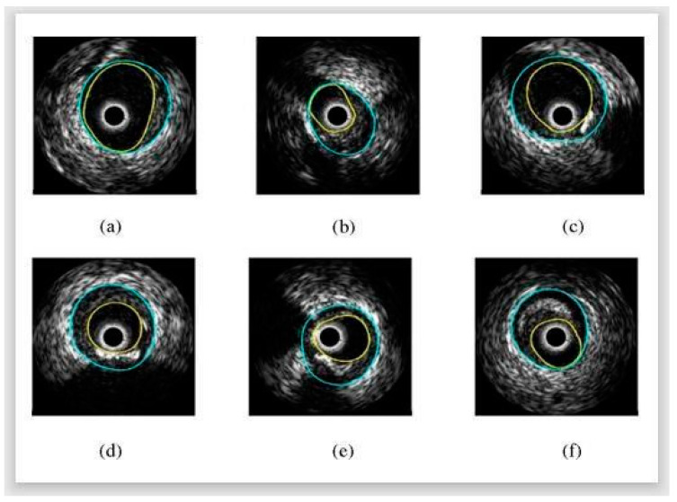 Figure 10