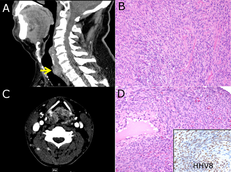 Fig. 3