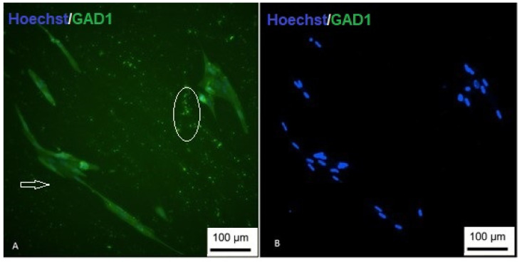 Figure 17