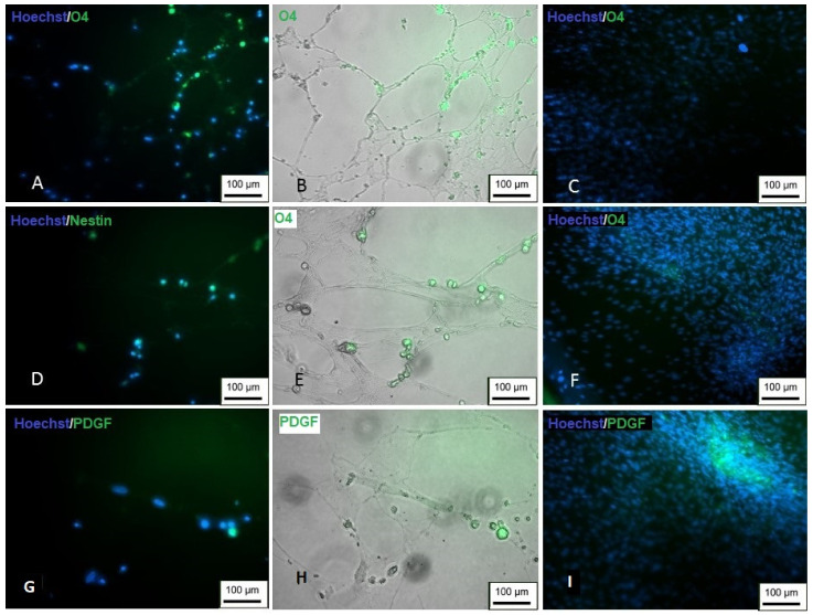 Figure 21