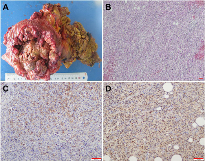 Fig. 2