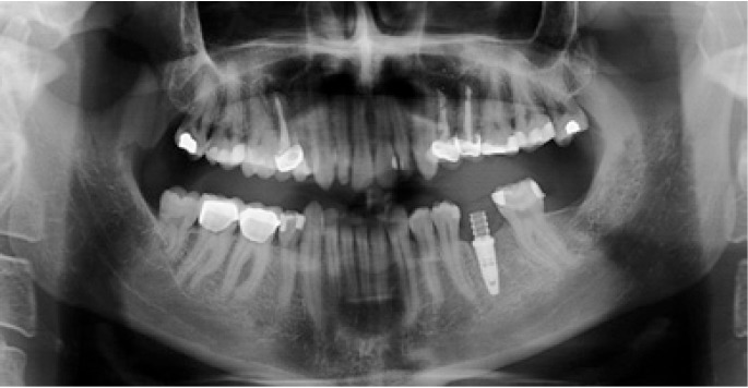 Figure 11