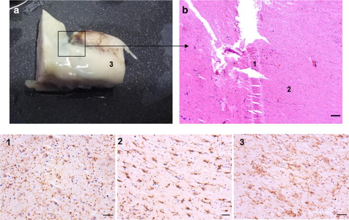 Fig. 3