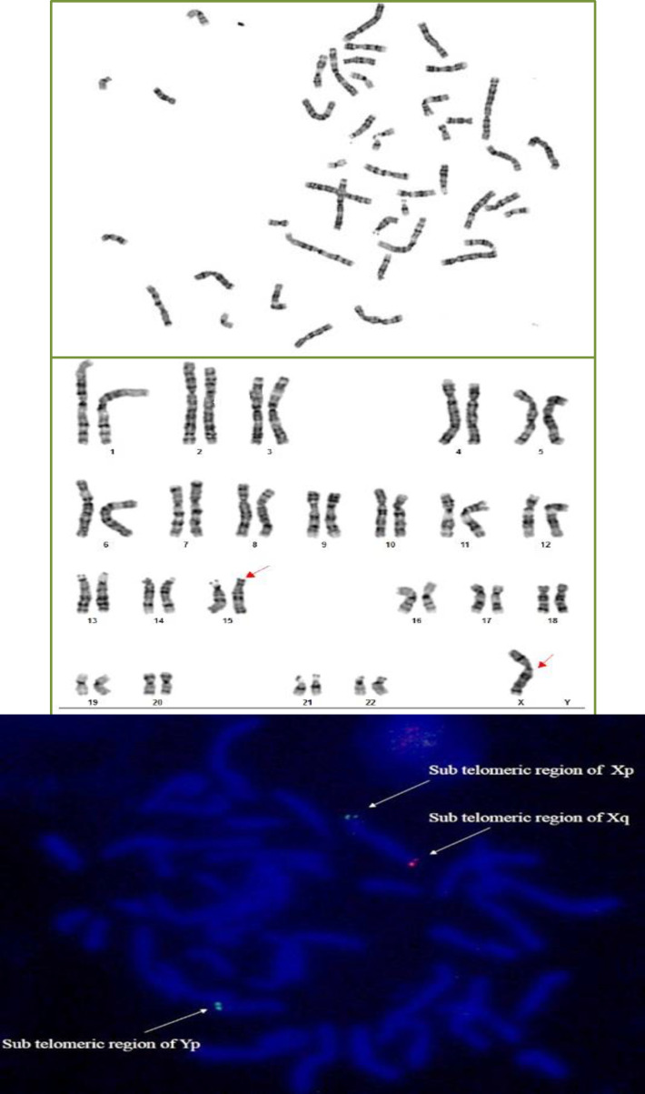 Figure 1a, b and c