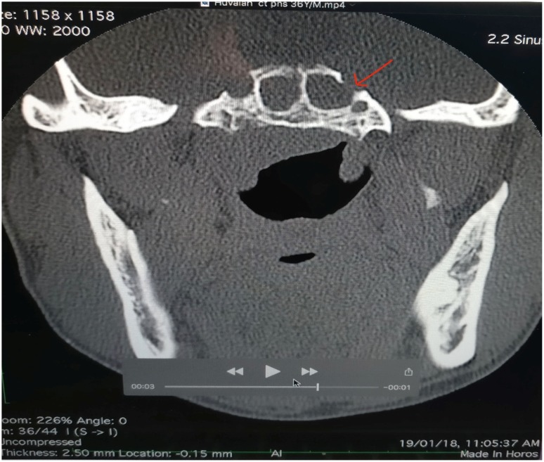 Fig. 2