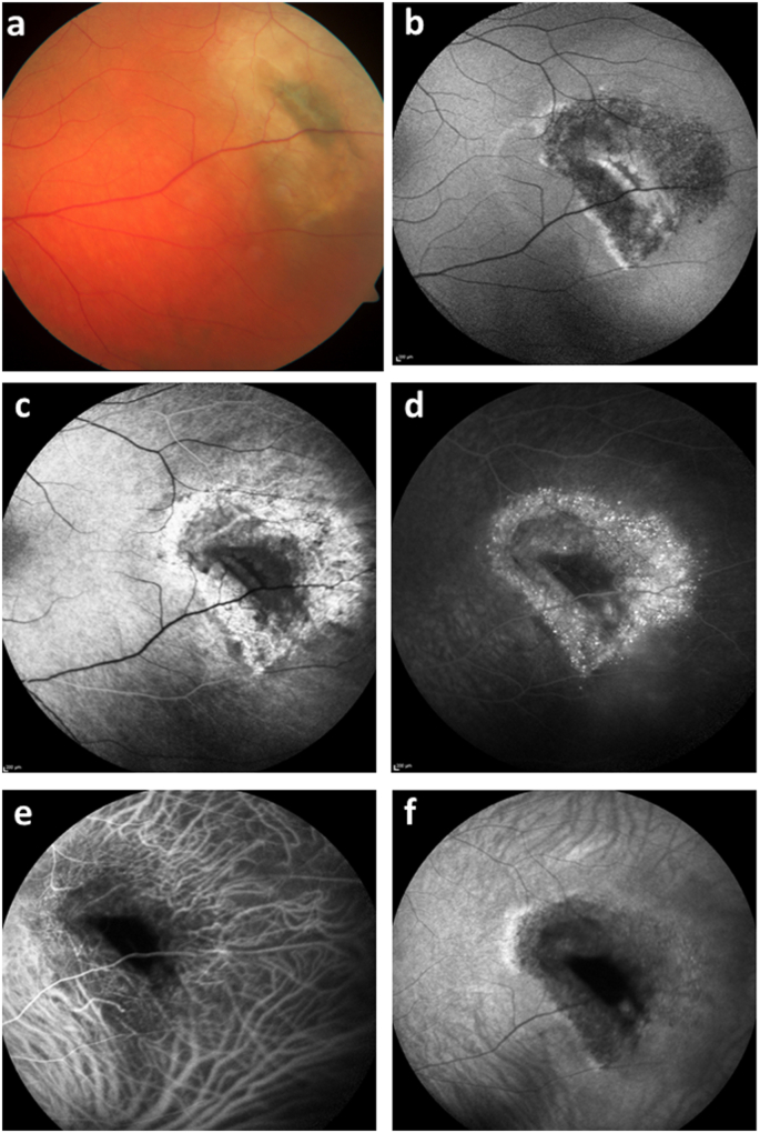 Fig. 1