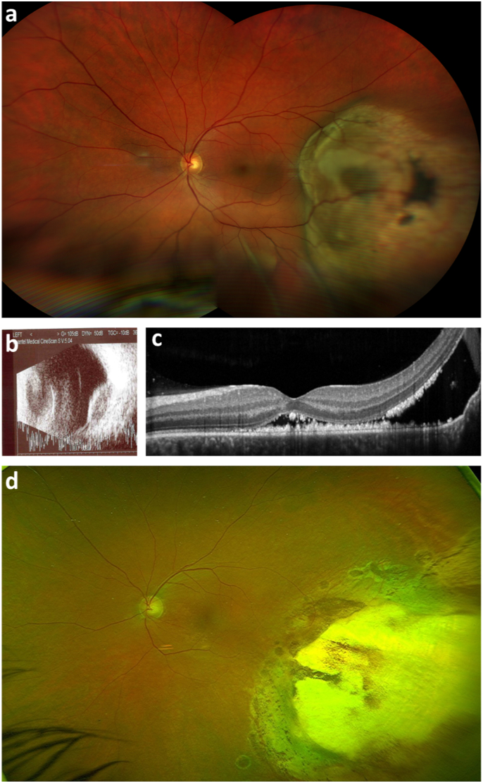 Fig. 4