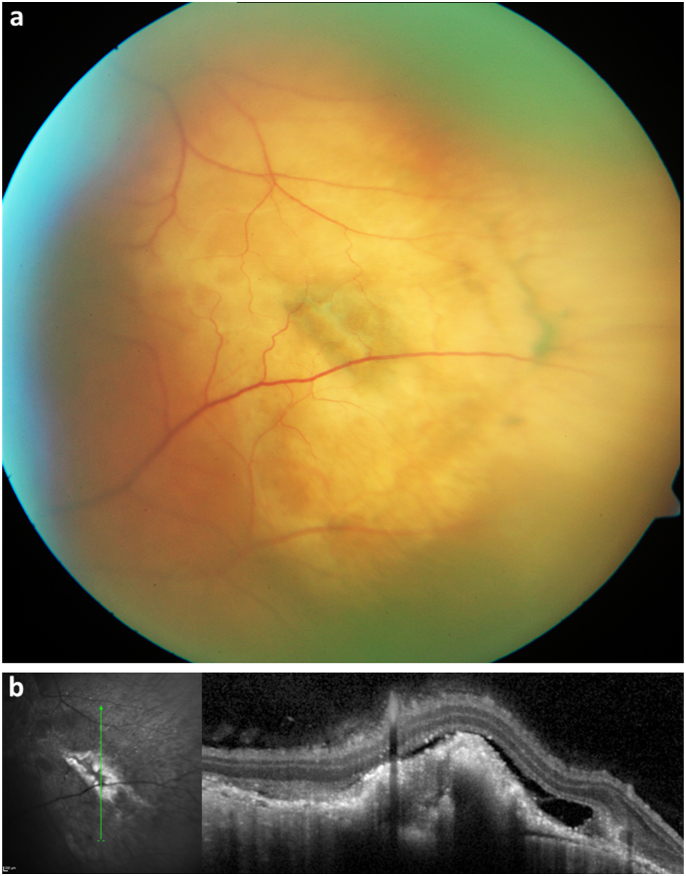 Fig. 3