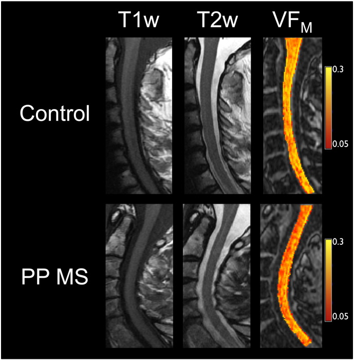 Fig. 4