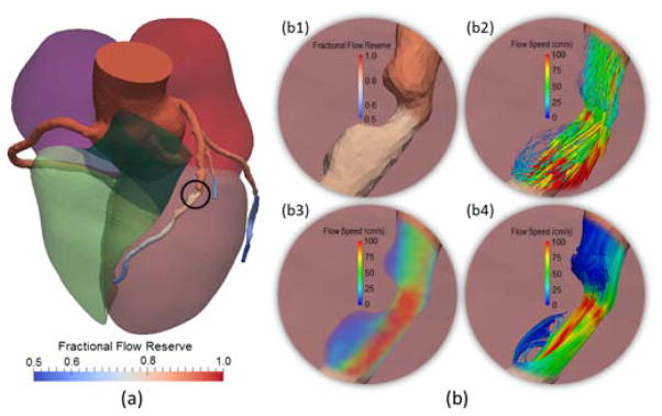 Fig. 12