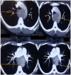 Fig. 2